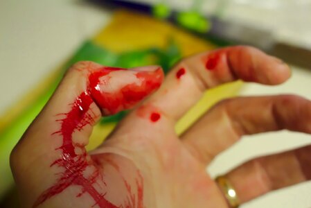 Bleeding finger blood chopping photo