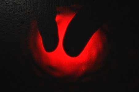 Fingertip Laser Squish--before photo