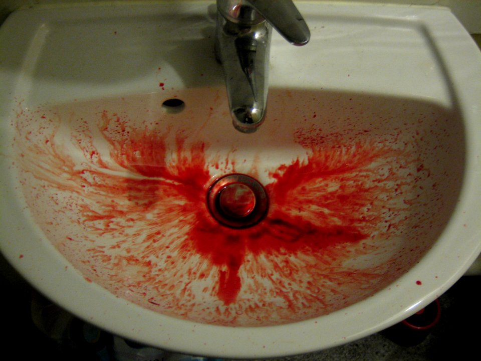 Nose Bleed Sink Story - 77