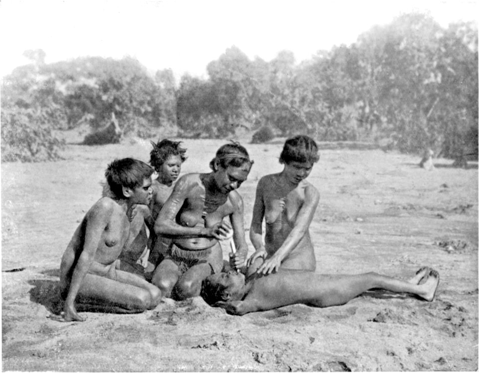 Knocking out a girl's tooth — Kaitish tribe