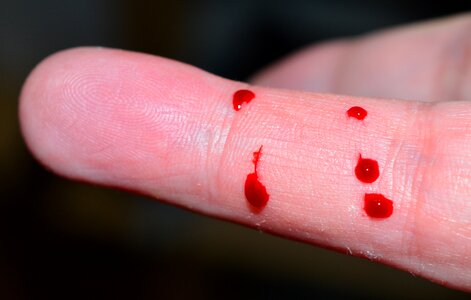 Drops of blood red bit