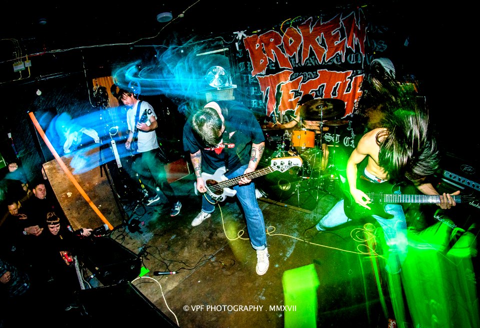 BROKEN TEETH