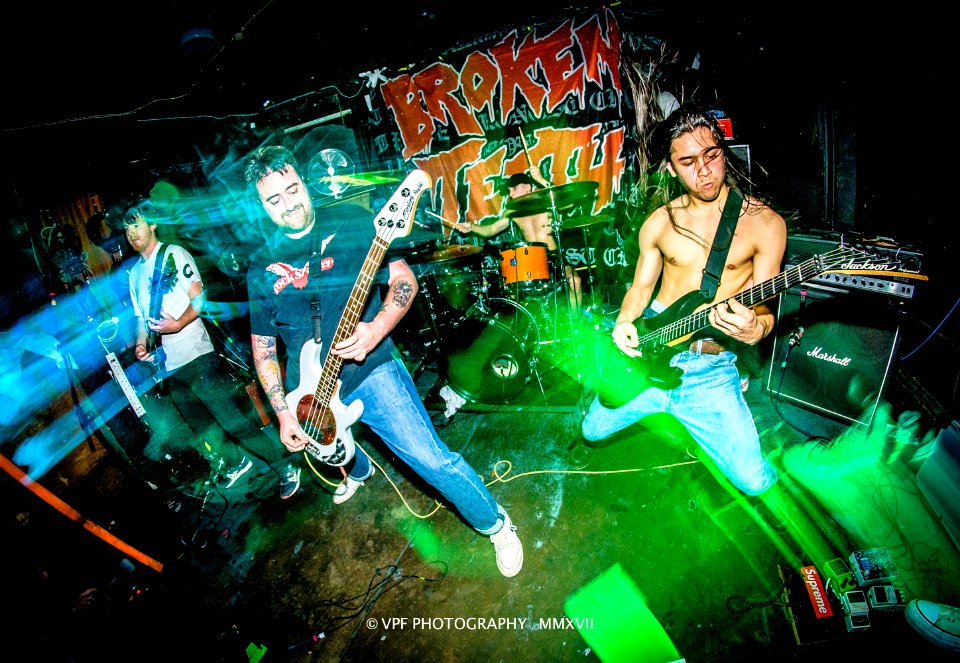 BROKEN TEETH