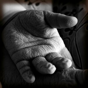 Open wrinkles aging