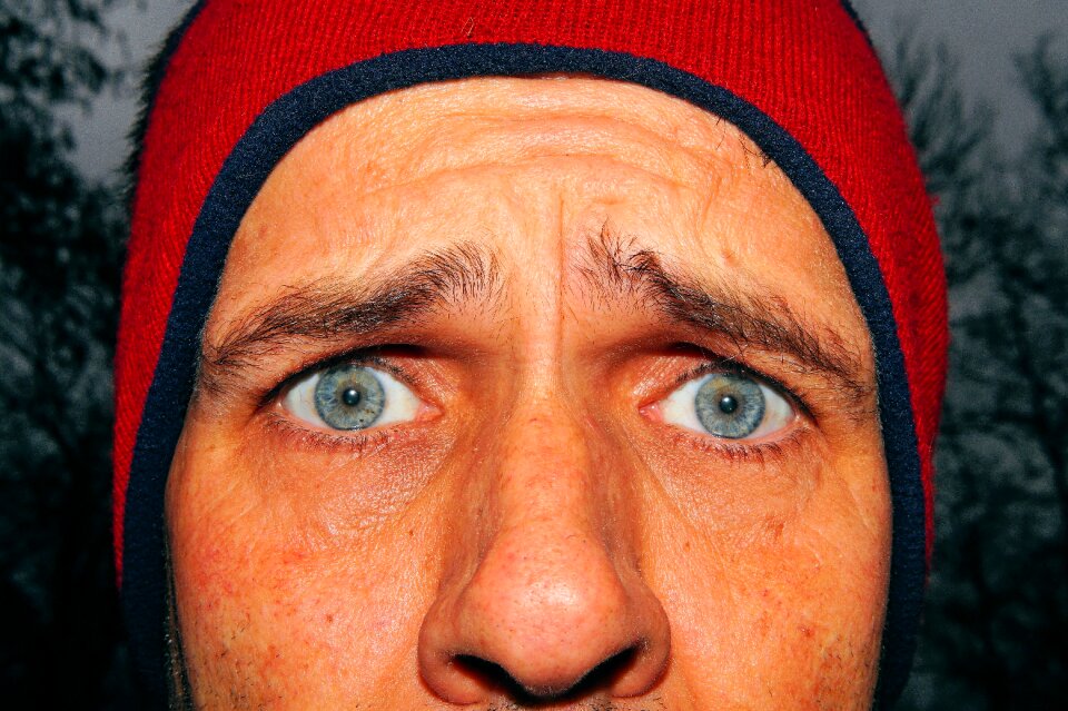 Depressed human eyes