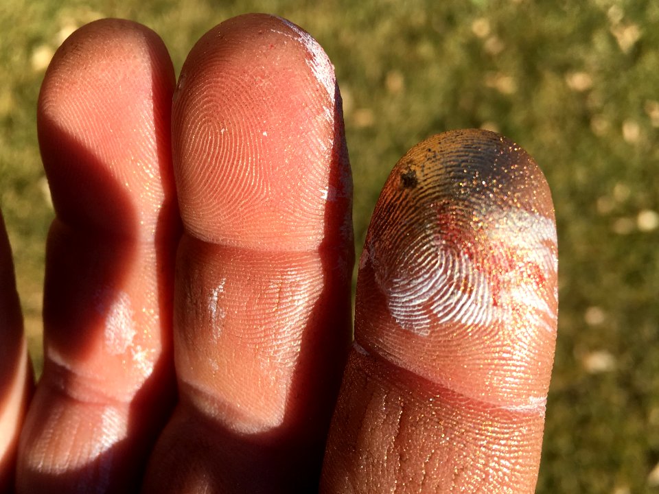 Spray Finger Syndrome