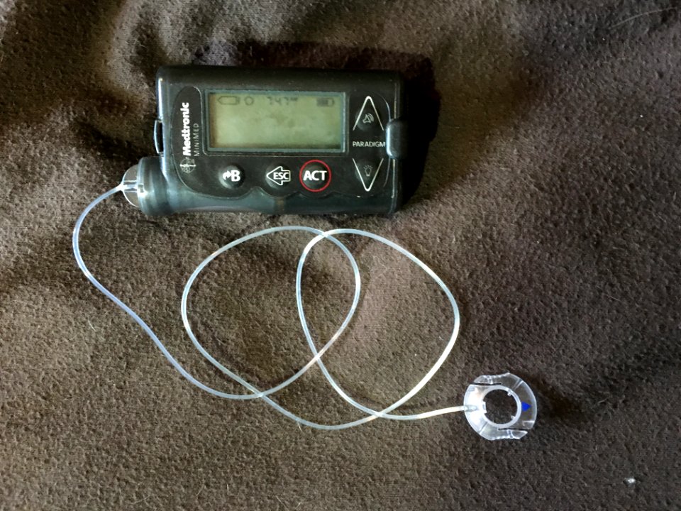 The Price of being Diabetic: Insulin Pump