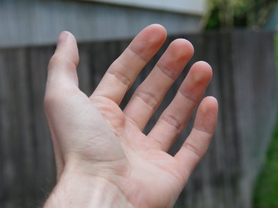 Hand photo