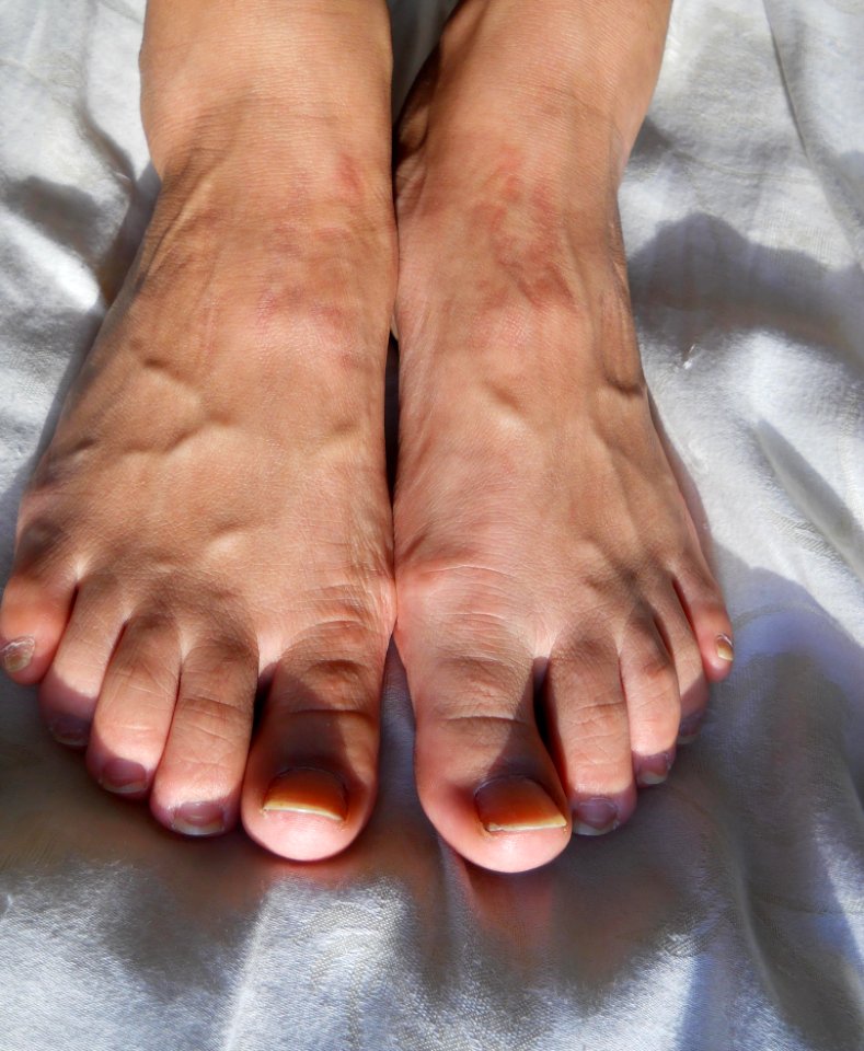 Moroccan Model doesnt wanna do anymore feet pics until the feet pics start getting 1000+ views