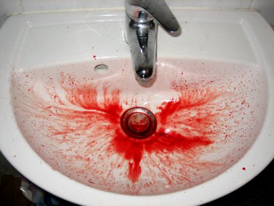 Nose Bleed Sink Story - 78 photo
