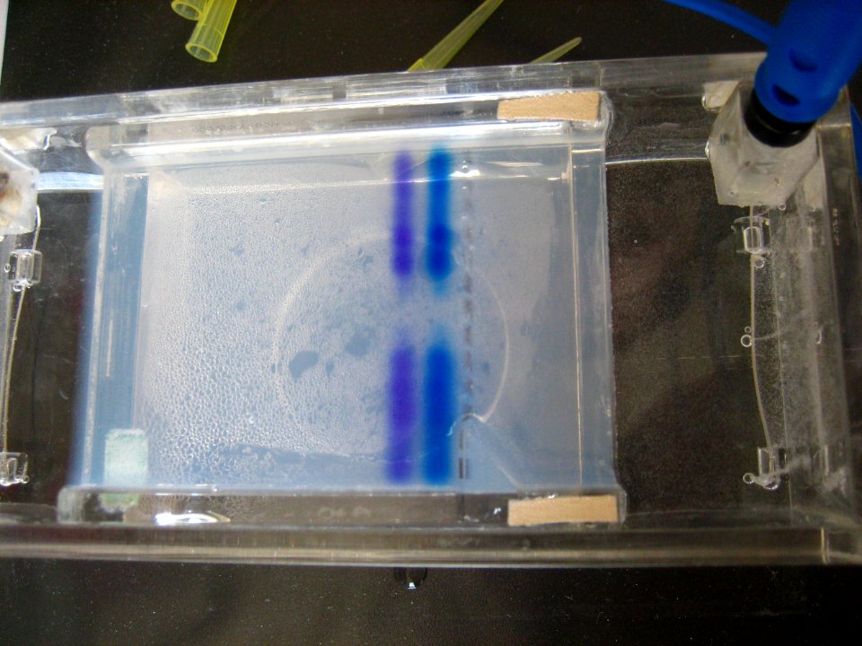 Gel electrophoresis photo