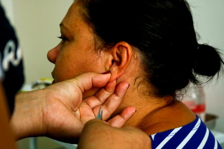 14.03.2018 - Atendimento com auriculoterapia a grupo crônico na UBS Virgílio Costa - Foto Michel Corvello-9