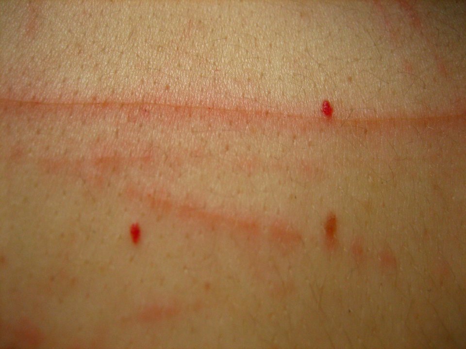 Scratched Skin Texture
