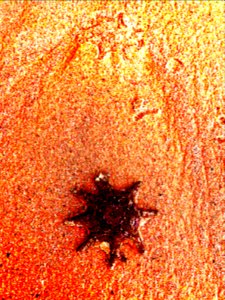 Starfish