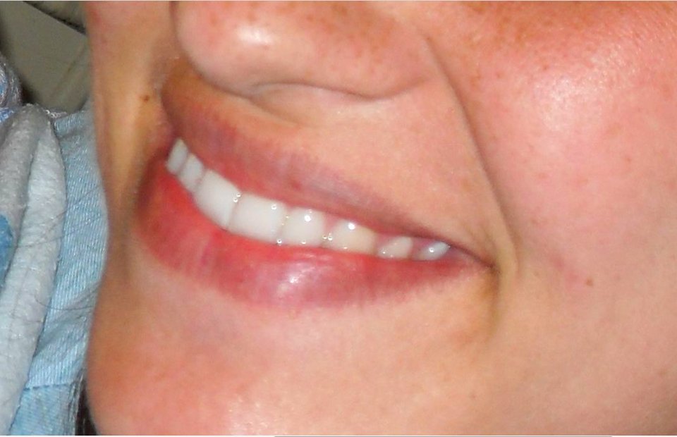 Smile 4