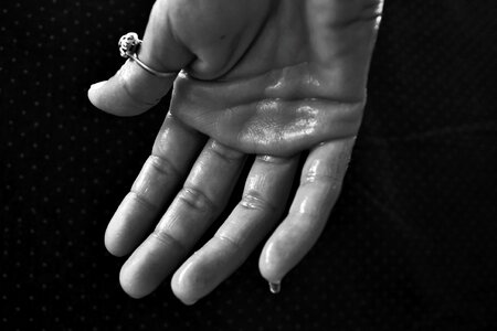 Sweat glands outburst purification