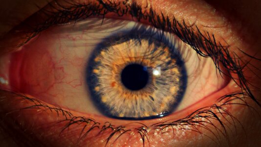 Pupil see red eyelashes