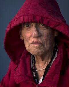 Elderly cleft palate