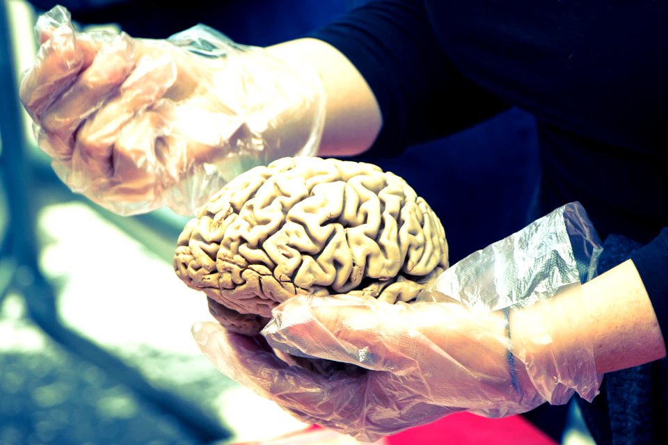 New york, Purchase, Brain