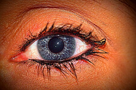 Black eye view close up