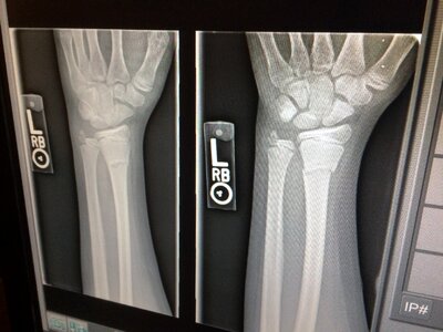 Arm doctor x ray photo