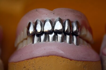 Orthodontic mouth oral photo