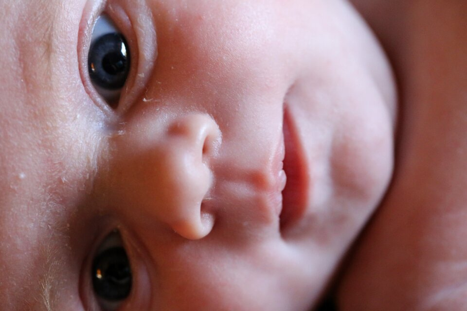 Flaky skin baby face baby eyes blue