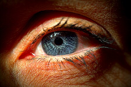 Black eye view close up