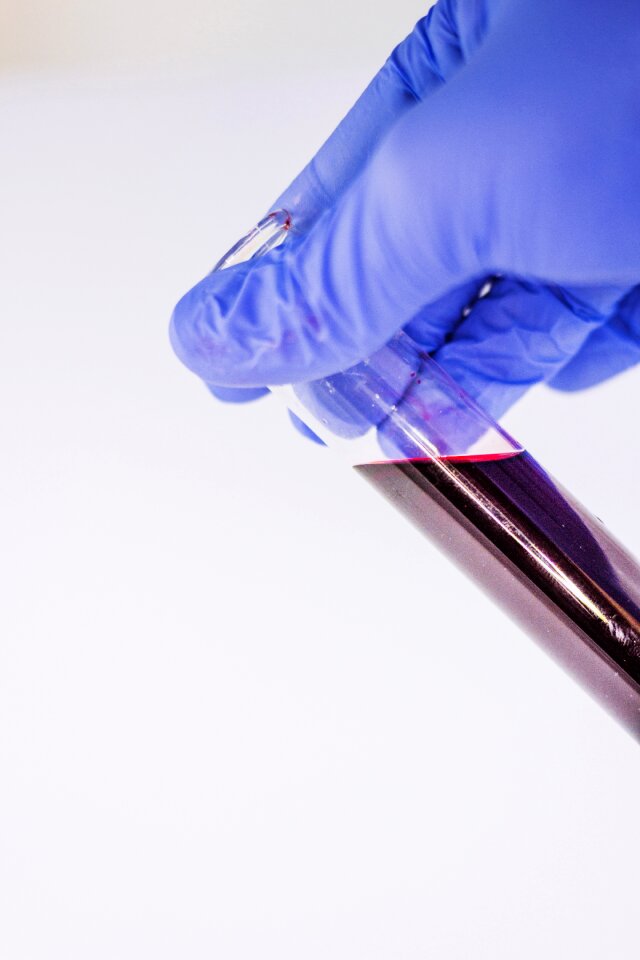 Tube diagnostics laboratory