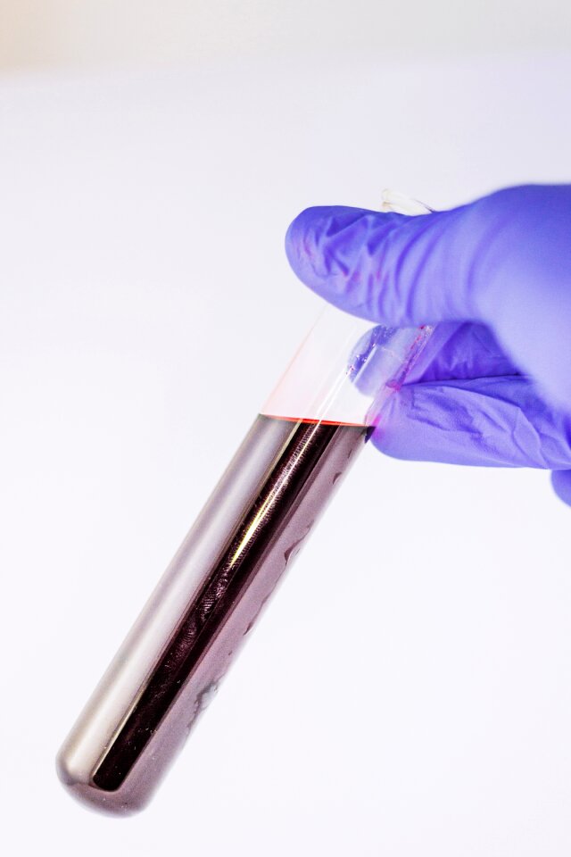 Tube diagnostics laboratory