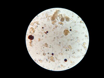 Soil microbes microscope soil sample photo