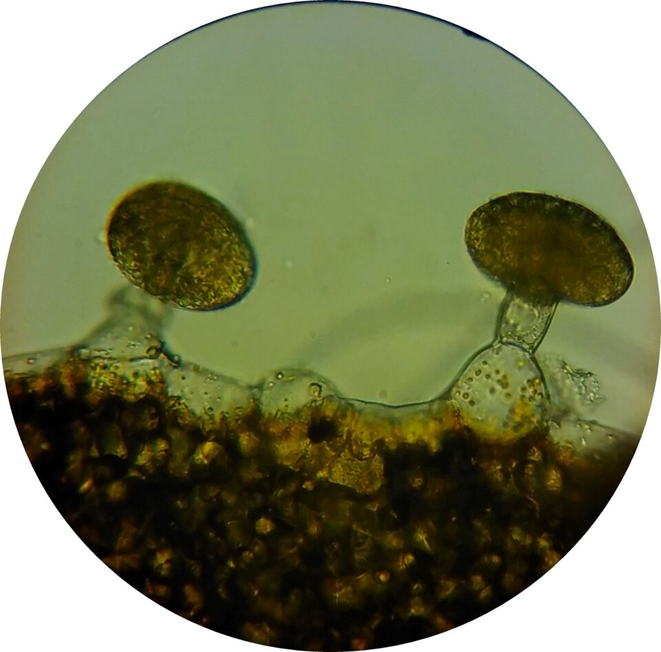 Loosestrife oil glands microscope image