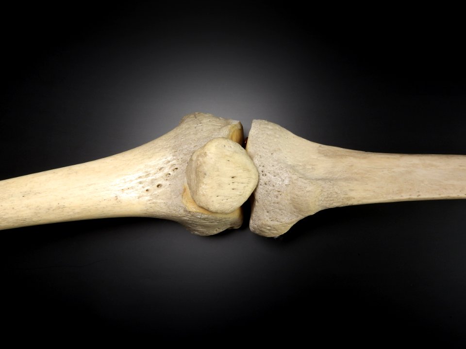 Articulatio genus - frontal