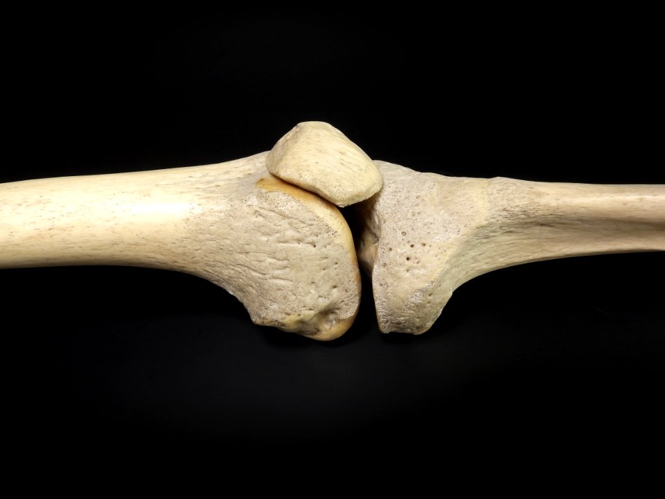 Articulatio genus - lateral