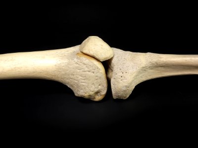 Articulatio genus - lateral