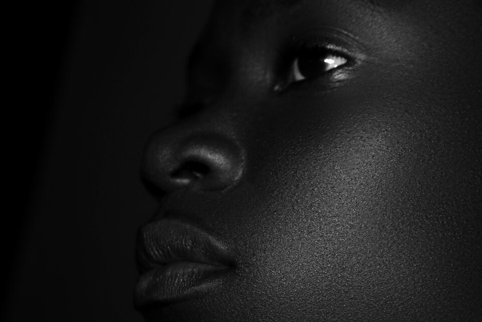 Female black skin check