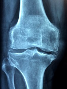 Injury pain knee pain photo