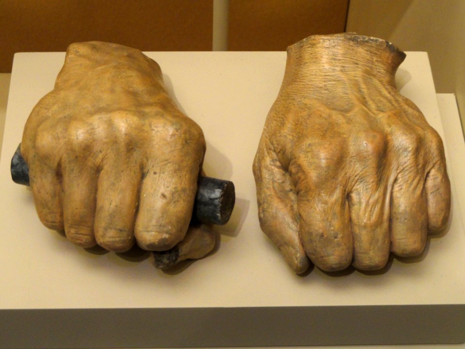 Casts of Abraham Lincoln's hands, taken by Leonard Volk on May 20, 1860 - National Museum of American History - DSC06294
