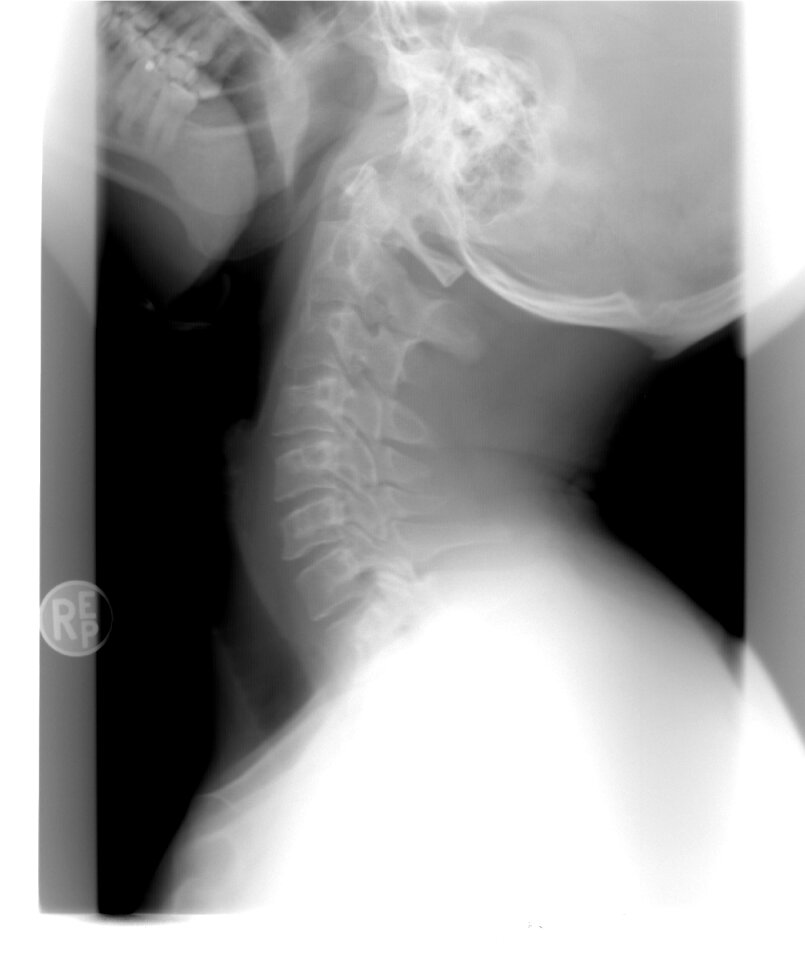Healthcare injury gray healthcare