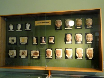 Child care exhibit, wax, 1920s - Arppeanum - DSC05445