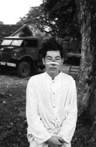 Chinese man met zwaar verwonde neus waarover een pleister is geplakt, Bestanddeelnr 7512