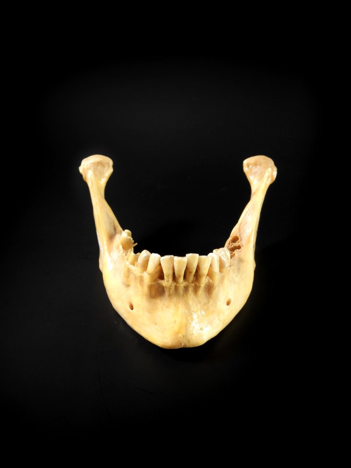 Cranium - mandibula (anterior)