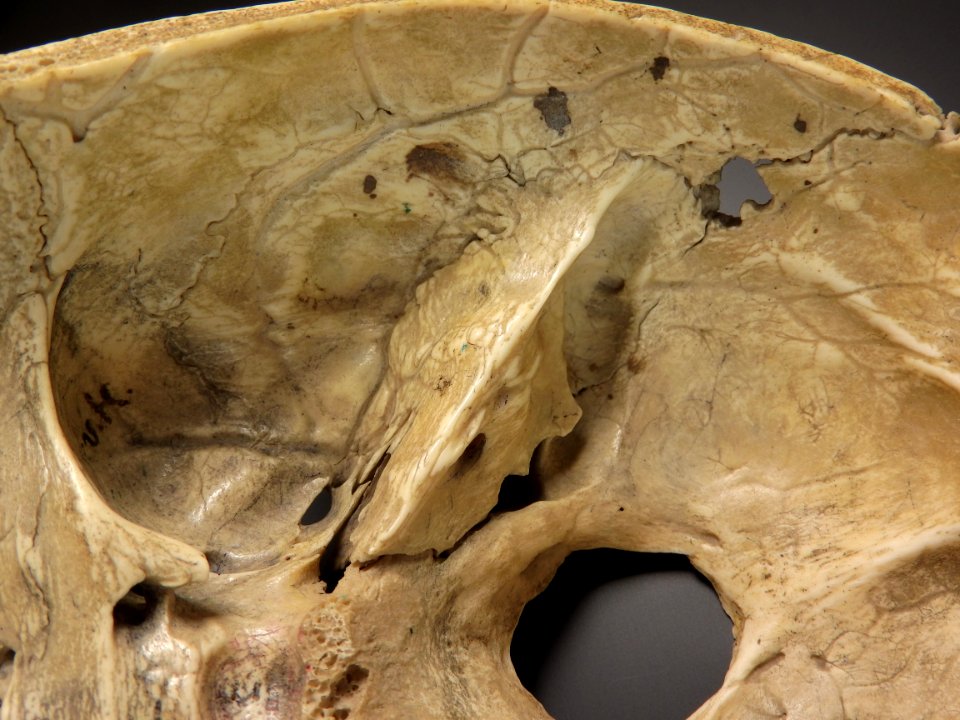 Cranium - os petrosum (basis cranii)