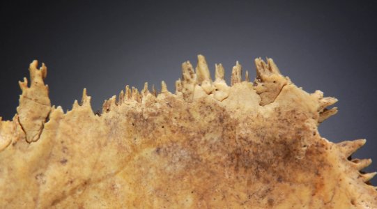 Cranium - os parietale - sutura, detail