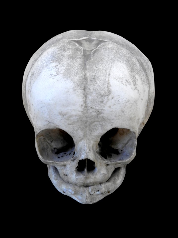 Cranium - baby, anterior view