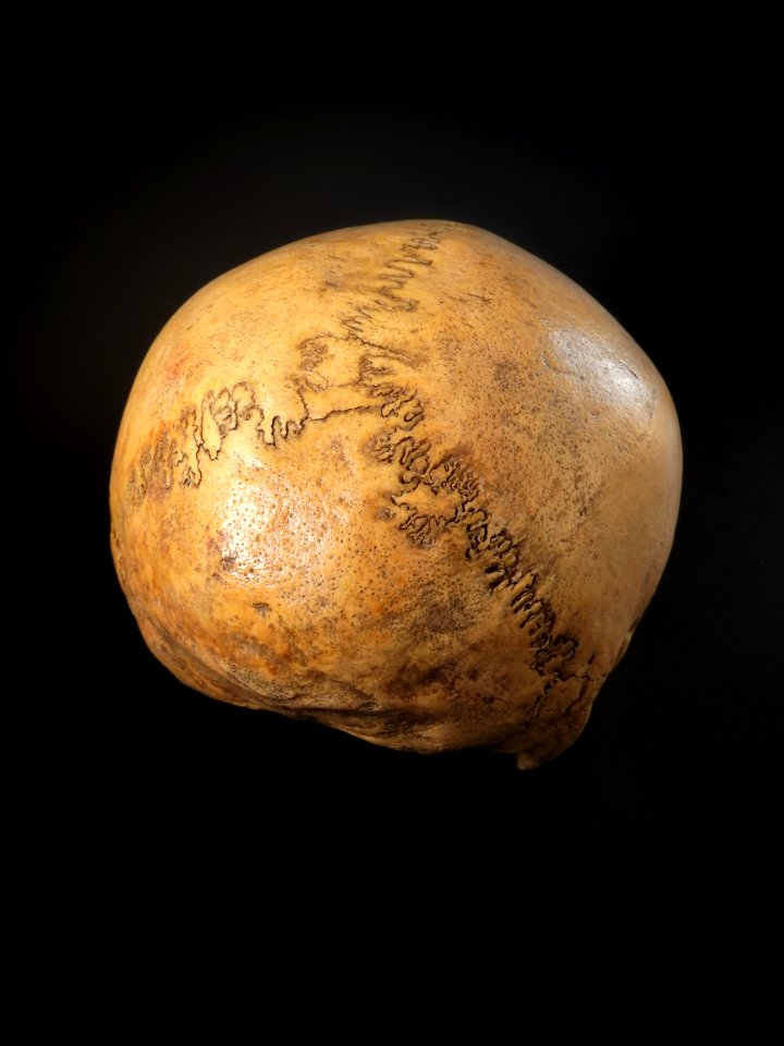 Cranium - neurocranium posterior view 3