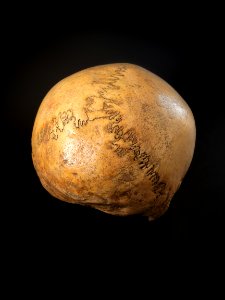 Cranium - neurocranium posterior view 3