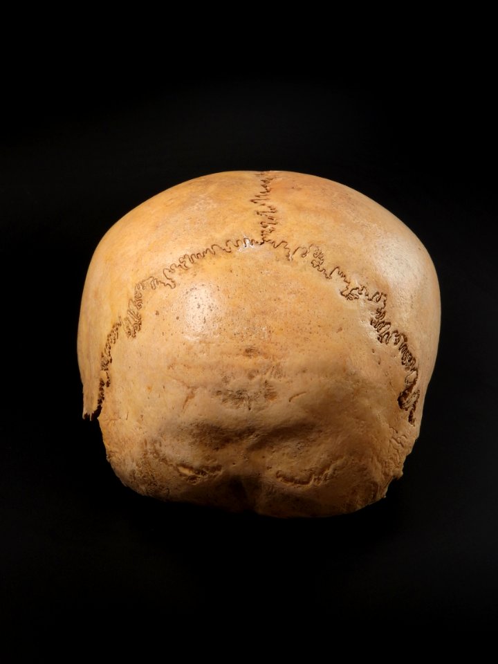 Cranium - neurocranium posterior view 2