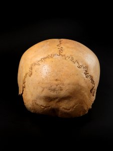 Cranium - neurocranium posterior view 2