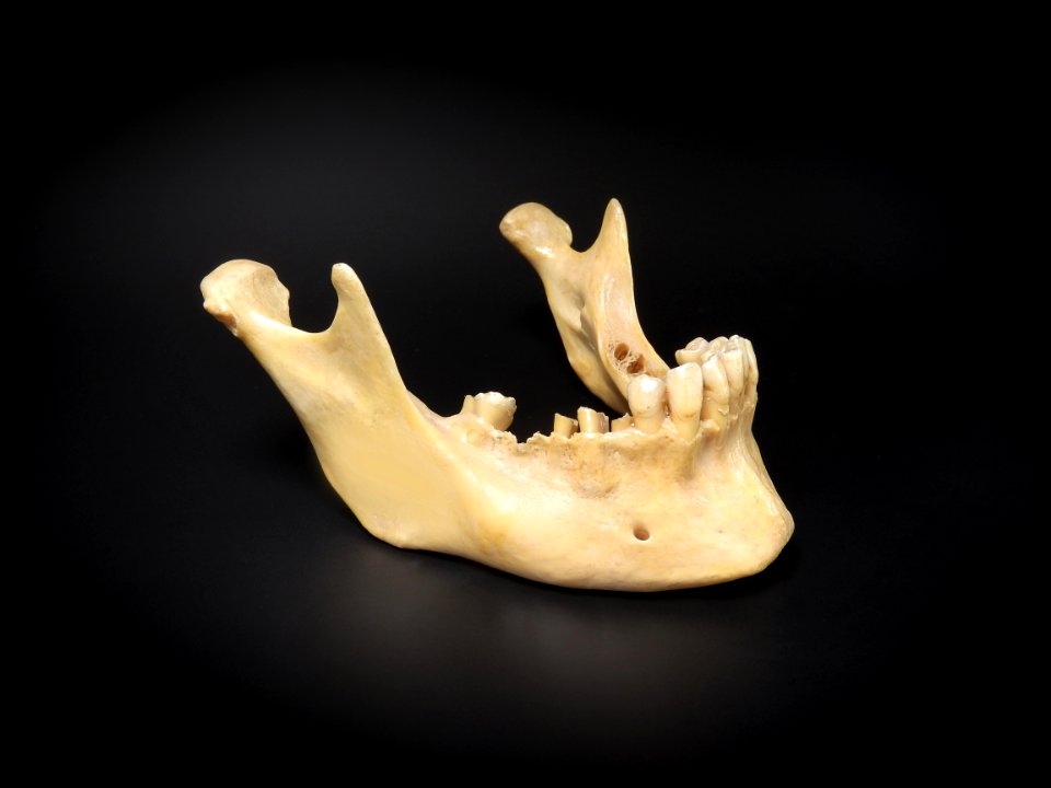 Cranium - mandibula (lateral view)